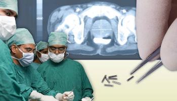 Лечение вагинального рака по стадиям